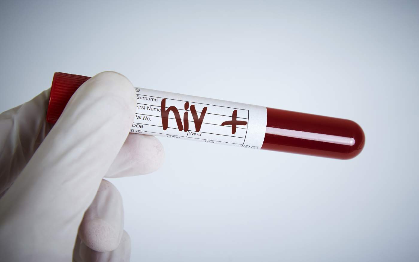 New Analysis Exposes Path to Affordable Lenacapavir for HIV Prevention
